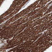 Anti-FGFR4 antibody produced in rabbit Prestige Antibodies® Powered by Atlas Antibodies, affinity isolated antibody, buffered aqueous glycerol solution, ab1