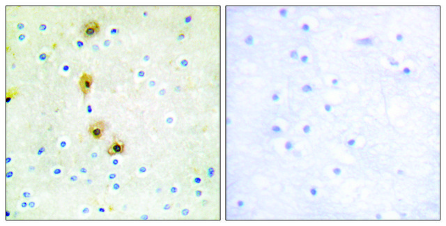 Anti-AKT antibody produced in rabbit affinity isolated antibody