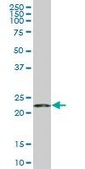 Monoclonal Anti-RPS5, (C-terminal) antibody produced in mouse clone 3G3, purified immunoglobulin, buffered aqueous solution