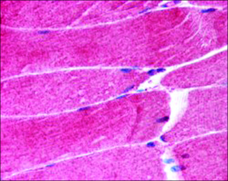 Anti-MURF1/TRIM63, N-Terminal antibody produced in goat affinity isolated antibody, buffered aqueous solution