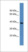 Anti-PHKG1 antibody produced in rabbit affinity isolated antibody