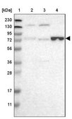 Anti-ENTPD4 antibody produced in rabbit Prestige Antibodies® Powered by Atlas Antibodies, affinity isolated antibody, buffered aqueous glycerol solution