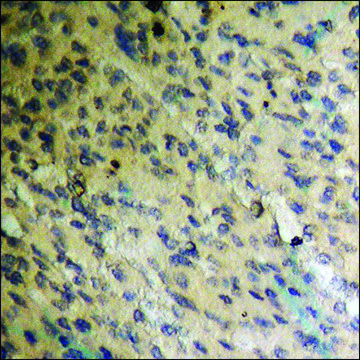 Anti-phospho-BAD (pSer91/128) antibody produced in rabbit affinity isolated antibody