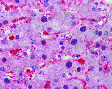 Anti-LDHA antibody produced in rabbit affinity isolated antibody