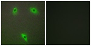 Anti-KLHL3 antibody produced in rabbit affinity isolated antibody
