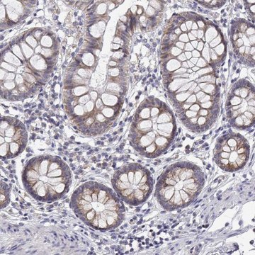 Anti-TRIM60 antibody produced in rabbit Prestige Antibodies&#174; Powered by Atlas Antibodies, affinity isolated antibody, buffered aqueous glycerol solution