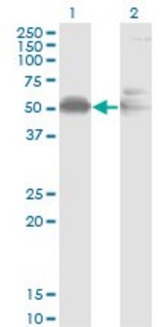 Monoclonal Anti-AHSG, (C-terminal) antibody produced in mouse clone 1D8, purified immunoglobulin, buffered aqueous solution