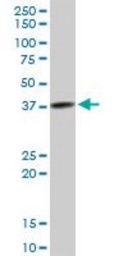 Anti-TFB2M antibody produced in mouse purified immunoglobulin, buffered aqueous solution