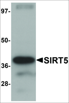 Anti-SIRT5 antibody produced in chicken affinity isolated antibody, buffered aqueous solution