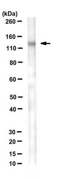 Anti-Desmoglein 3 Antibody, clone 5H10 clone 5H10, from mouse