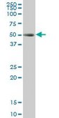 Monoclonal Anti-TCF2 antibody produced in mouse clone 3E11, purified immunoglobulin, buffered aqueous solution