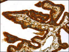 Anti-TP53I11 affinity isolated antibody