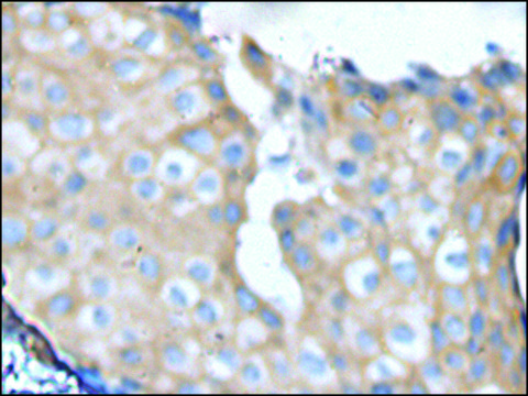 Anti-NF1 affinity isolated antibody