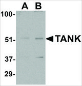 Anti-TANK (ab2) antibody produced in rabbit affinity isolated antibody, buffered aqueous solution