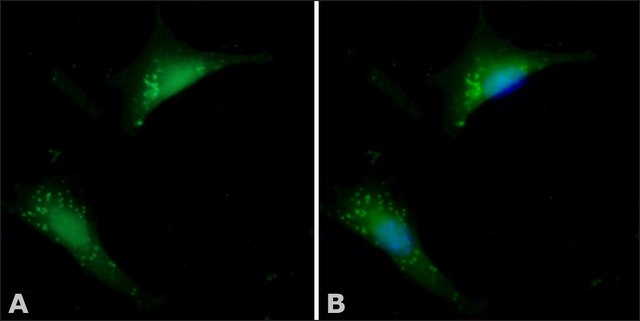 Anti-Cofilin antibody produced in rabbit IgG fraction of antiserum, buffered aqueous solution