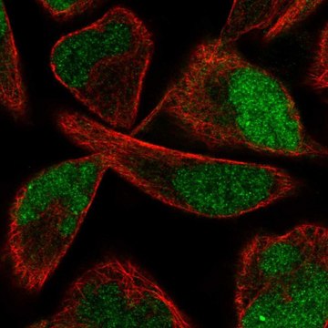 Anti-PPME1 antibody produced in rabbit Prestige Antibodies&#174; Powered by Atlas Antibodies, affinity isolated antibody