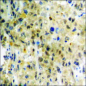 Anti-phospho-IKK-α (pThr23) antibody produced in rabbit affinity isolated antibody