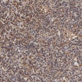 Anti-UBE2L6 antibody produced in rabbit Prestige Antibodies® Powered by Atlas Antibodies, affinity isolated antibody, buffered aqueous glycerol solution