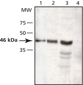 抗-TSG101 兔抗 ~2&#160;mg/mL, affinity isolated antibody, buffered aqueous solution