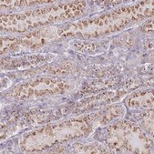 Anti-CHMP4B antibody produced in rabbit Prestige Antibodies® Powered by Atlas Antibodies, affinity isolated antibody, buffered aqueous glycerol solution