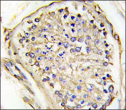 Anti-JUNCTOPHILIN 3 (C-term) antibody produced in rabbit IgG fraction of antiserum, buffered aqueous solution