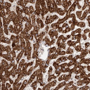 Anti-SLC25A20 antibody produced in rabbit Prestige Antibodies&#174; Powered by Atlas Antibodies, affinity isolated antibody, buffered aqueous glycerol solution