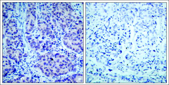 Anti-HDAC2 (Ab-394) antibody produced in rabbit affinity isolated antibody