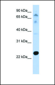 Anti-CHIC2, (N-terminal) antibody produced in rabbit affinity isolated antibody