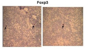 Anti-FOXP3 IgG fraction of antiserum