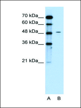 Anti-CHGA affinity isolated antibody