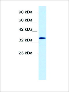 Anti-DLX6 antibody produced in rabbit affinity isolated antibody