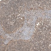 Anti-F8A1 antibody produced in rabbit Prestige Antibodies® Powered by Atlas Antibodies, affinity isolated antibody, buffered aqueous glycerol solution