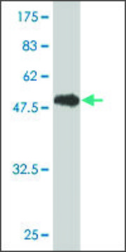 Monoclonal Anti-GSTT1 antibody produced in mouse clone 2E10-1B2, purified immunoglobulin, buffered aqueous solution