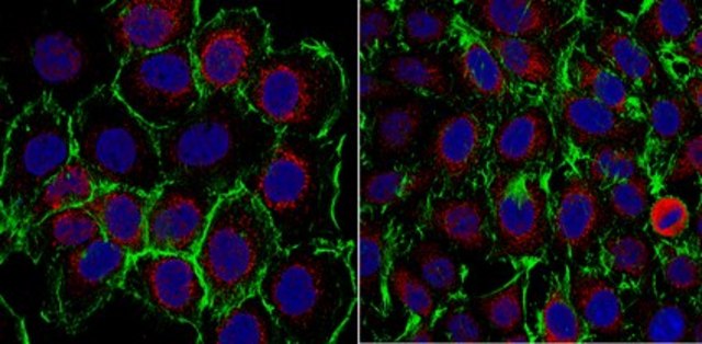 Anti-RINT-1 Antibody from rabbit, purified by affinity chromatography