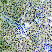 Anti-phospho-GR (pSer226) antibody produced in rabbit affinity isolated antibody
