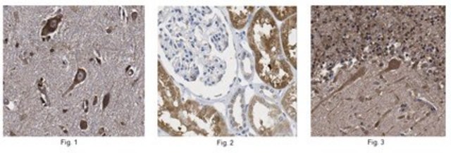 Anti-3-PGDH Antibody from rabbit, purified by affinity chromatography