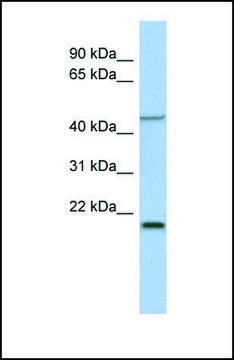 Anti-KLF15 antibody produced in rabbit affinity isolated antibody