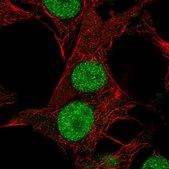 Anti-DHRS12 antibody produced in rabbit Prestige Antibodies® Powered by Atlas Antibodies, affinity isolated antibody, buffered aqueous glycerol solution