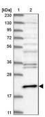 Anti-CETN3 antibody produced in rabbit Prestige Antibodies® Powered by Atlas Antibodies, affinity isolated antibody, buffered aqueous glycerol solution