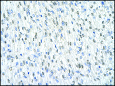 Anti-SF3B1 (AB1) antibody produced in rabbit IgG fraction of antiserum