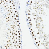 Anti-ZEB1 antibody produced in rabbit
