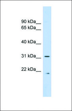 Anti-CAPNS1 antibody produced in rabbit affinity isolated antibody