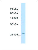 Anti-MUC1 (AB2) antibody produced in rabbit IgG fraction of antiserum