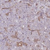 Anti-PSMB8 antibody produced in rabbit Prestige Antibodies® Powered by Atlas Antibodies, affinity isolated antibody, buffered aqueous glycerol solution