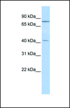 Anti-KLHL3 antibody produced in rabbit affinity isolated antibody