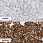 Breast Analyte Control Cell line controls for immunohistochemistry and in situ hybridization