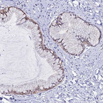 Anti-ZMIZ1 antibody produced in rabbit Prestige Antibodies&#174; Powered by Atlas Antibodies, affinity isolated antibody, buffered aqueous glycerol solution