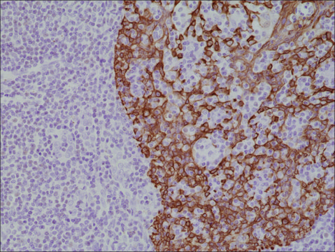 Anti-CK-14 (Cytokeratin-14) antibody, Rabbit monoclonal recombinant, expressed in HEK 293 cells, clone RM328, purified immunoglobulin