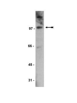 Anti-Daxx Antibody serum, Upstate&#174;