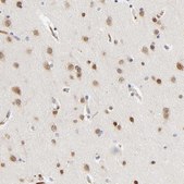 Anti-NOVA1 antibody produced in rabbit Prestige Antibodies® Powered by Atlas Antibodies, affinity isolated antibody, buffered aqueous glycerol solution